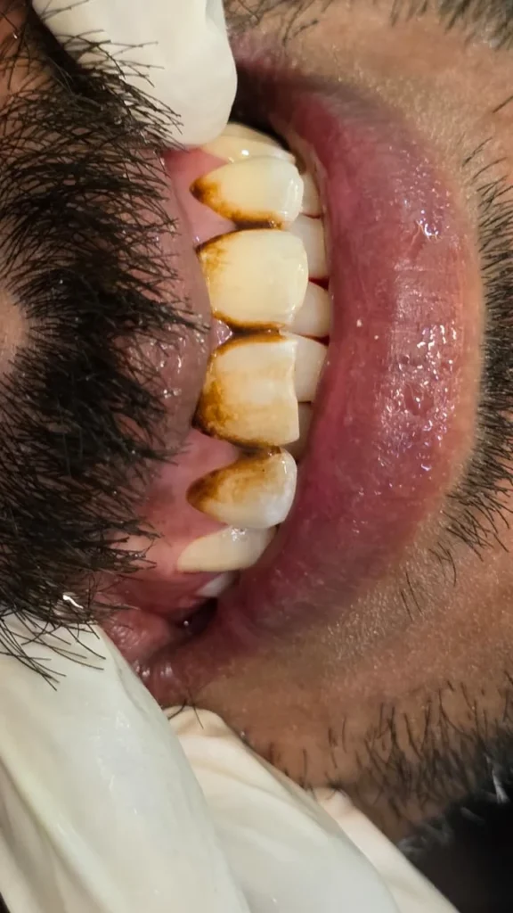 whatsapp image 2026 04 02 at 6.49.26 pm (1)